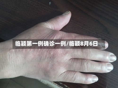 临颖第一例确诊一例/临颖8月6日-第2张图片