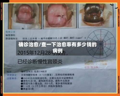 确诊治愈/查一下治愈率有多少钱的病例