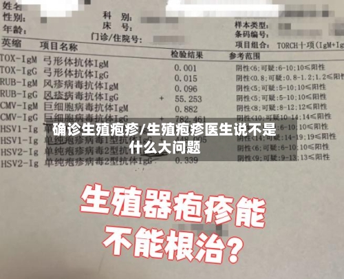 确诊生殖疱疹/生殖疱疹医生说不是什么大问题