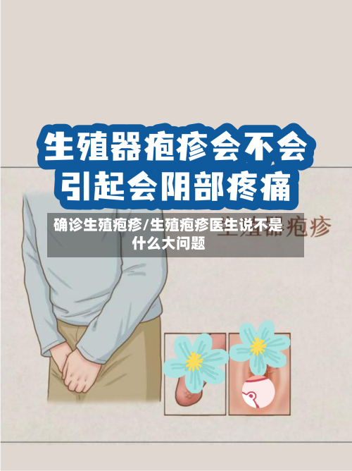 确诊生殖疱疹/生殖疱疹医生说不是什么大问题-第2张图片