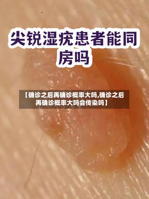 【确诊之后再确诊概率大吗,确诊之后再确诊概率大吗会传染吗】