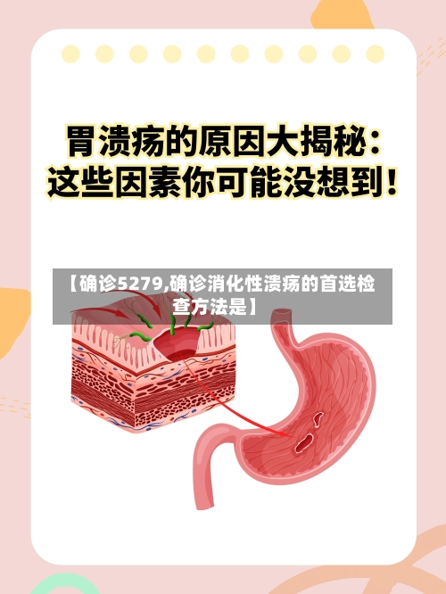【确诊5279,确诊消化性溃疡的首选检查方法是】-第2张图片