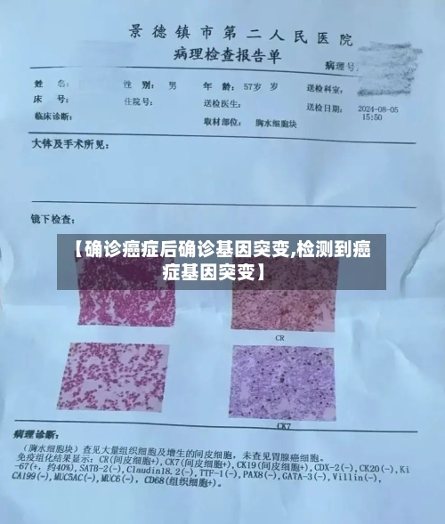 【确诊癌症后确诊基因突变,检测到癌症基因突变】